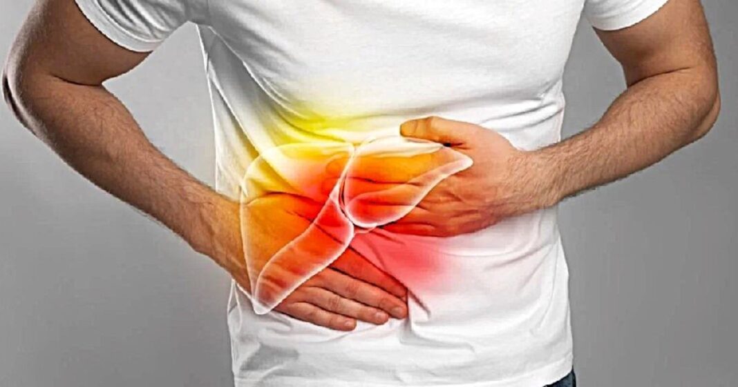 Ilustración médica de un hígado humano mostrando tejido sano y áreas afectadas.