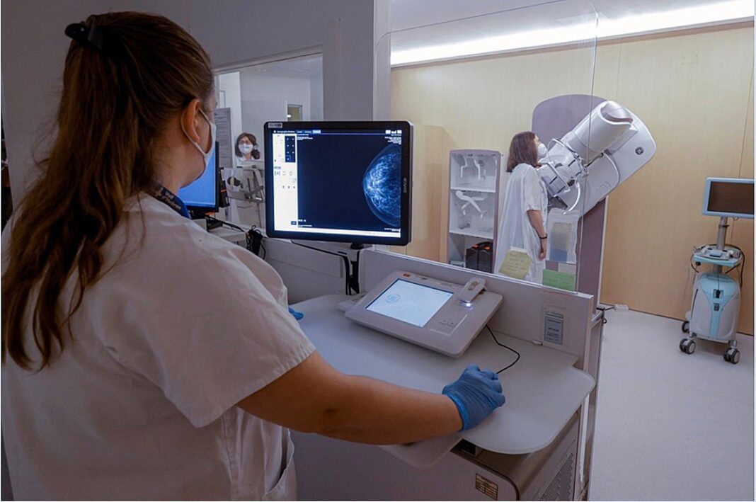 Microscopía de células de cáncer de mama con marcación de azúcares en superficie