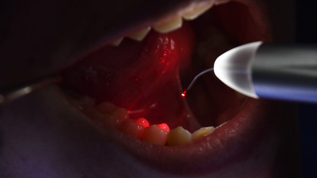 Equipo láser odontológico en consultorio dental