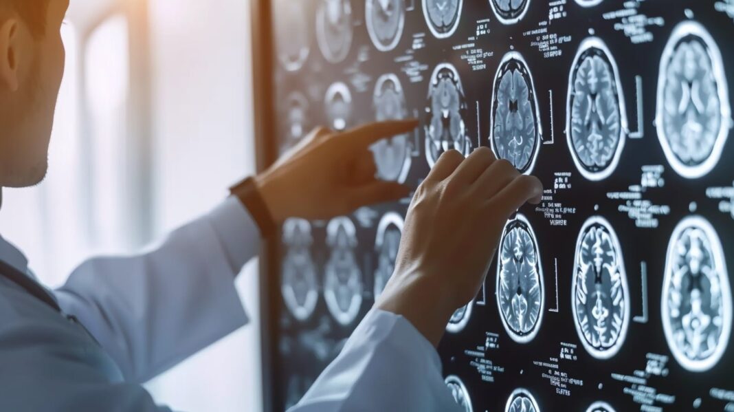 Louna, adolescente francesa que superó un cáncer cerebral