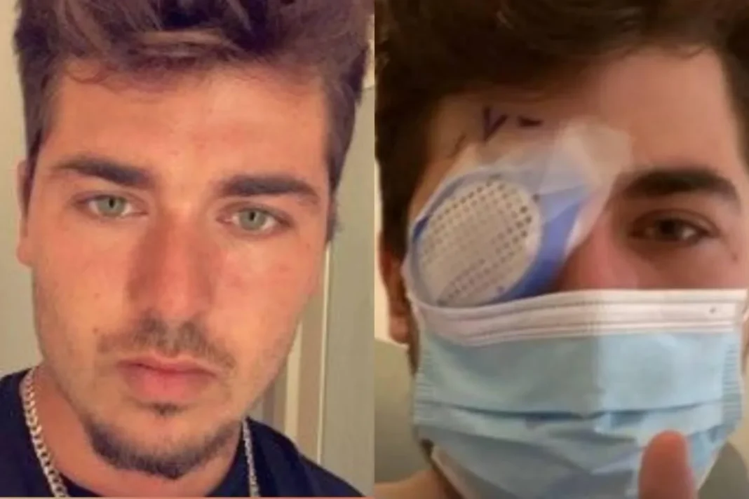 Joven con los ojos irritados a causa de una infección por lentes de contacto